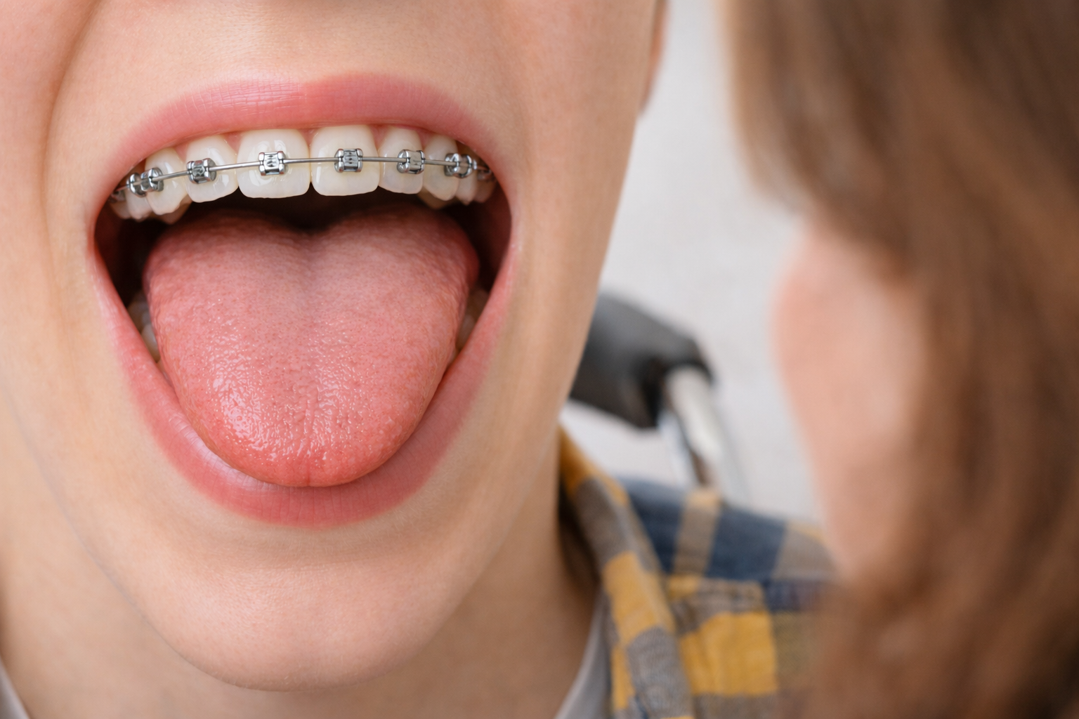 Zahnspange, MFT, falsches Schluckmuster, orofaziale Dysfunktion, Kieferorthopädie, Kaufbeuren